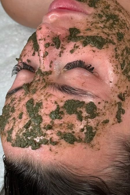 One Algae Peel, January 2026, during