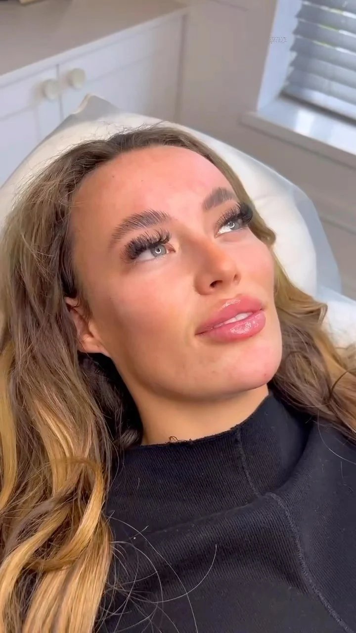 Facial contouring