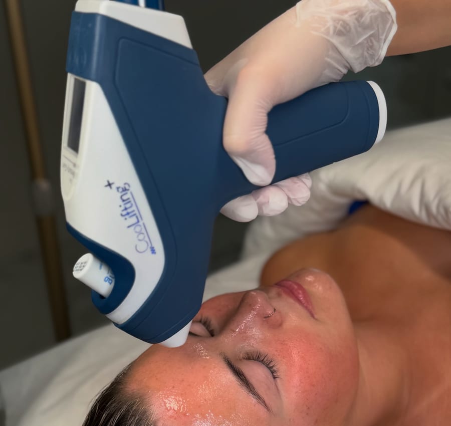 A skin treatment in the Angel Aesthetics clinic