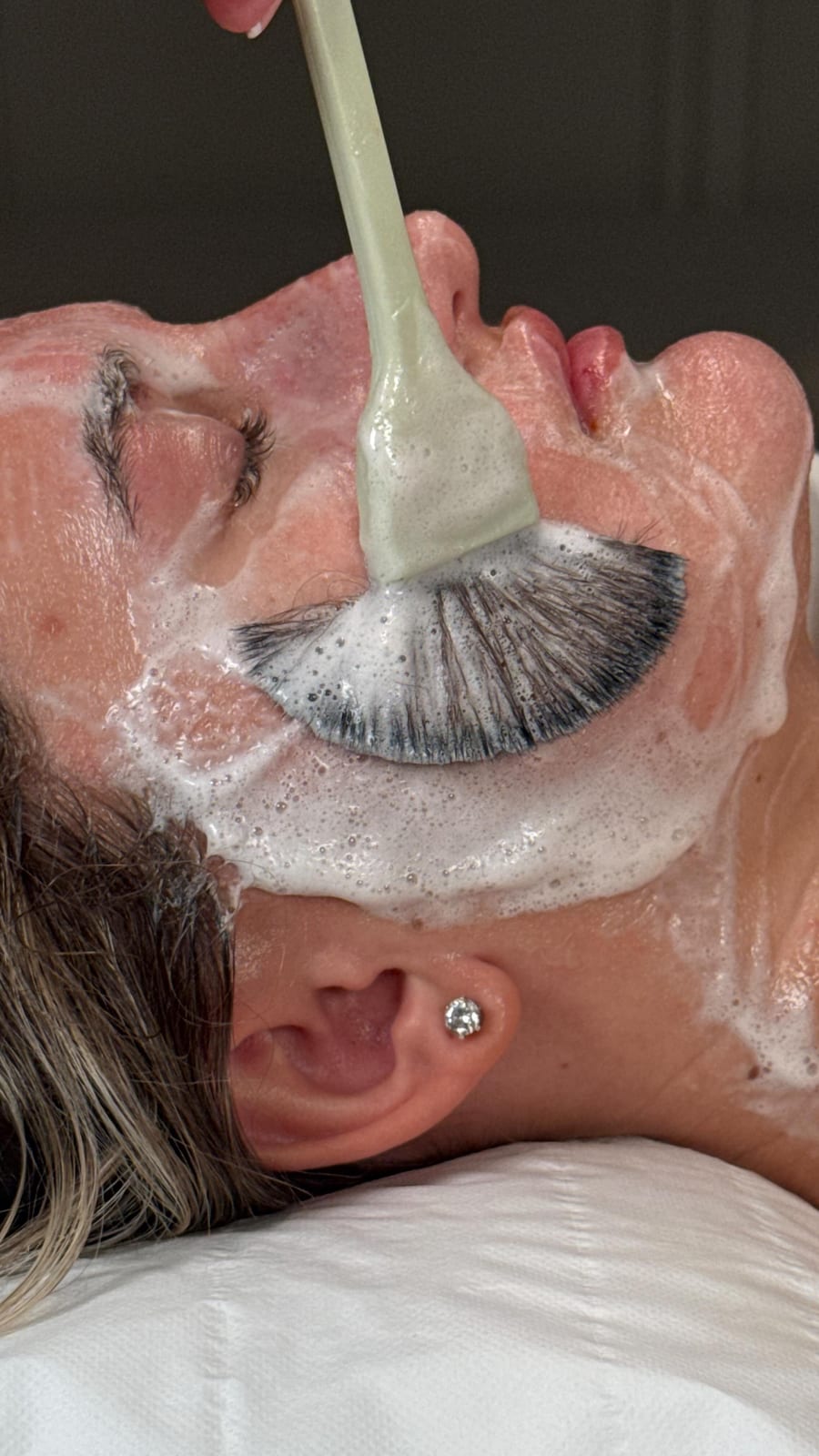 A DECAAR facial treatment at Angel Aesthetics