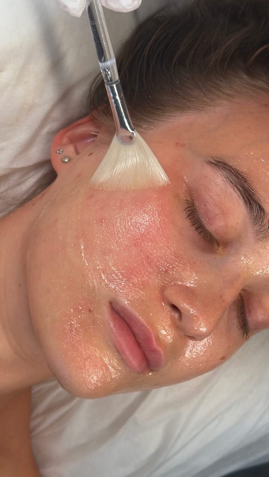 Facials at Angel